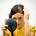 Iron-Deficiency Anemia and Hair Loss: Causes, Treatments, and Solutions