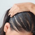 Hairstyles for Thinning Hair: Solutions and Tips