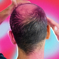 Hairstyles for Thinning Hair: Tips and Tricks to Prevent and Manage Male Pattern Baldness