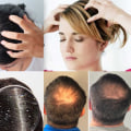 How to Use Scalp Massage for Hair Growth