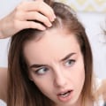 Understanding Medical Treatments for Female Hair Loss