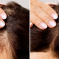 Hair Care Routine for Managing Female Hair Loss: Tips and Solutions