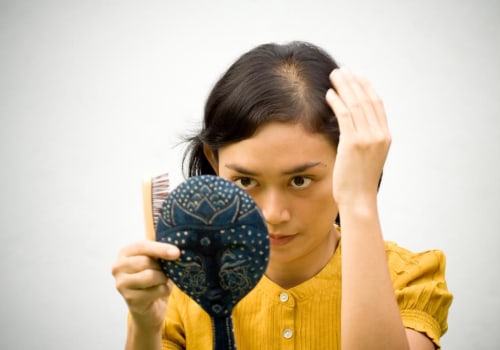 Iron-Deficiency Anemia and Hair Loss: Causes, Treatments, and Solutions