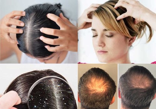 How to Use Scalp Massage for Hair Growth