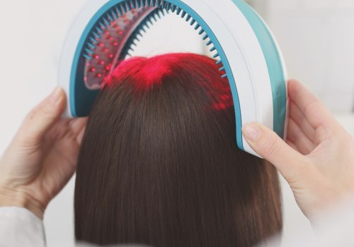 Understanding Low-Level Laser Therapy for Hair Loss